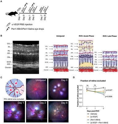 Caspase-9 inhibition confers stronger neuronal and vascular protection compared to VEGF neutralization in a mouse model of retinal vein occlusion